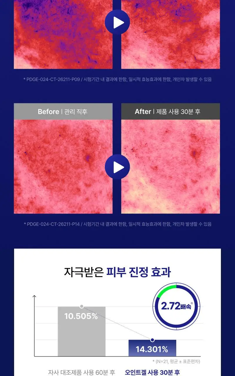 [트러블SOS진정]이지듀 EGFx 다운타임 오인트 겔 15ml 기획(+크림 7ml) 상세페이지 12